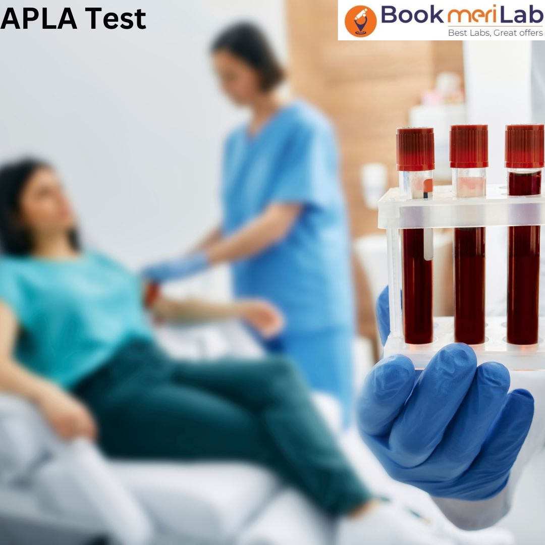 Unveiling Insights: The Apla Test